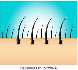 Active ingredient treatment deep into hair and scalp. skin hair vector. a healthy scalp and the scalp is affected by inflammation and dandruff.