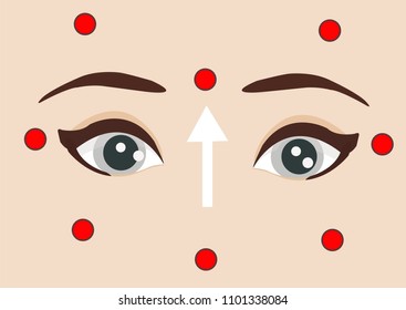 acupuncture for health. between two brows. facial acupuncture points