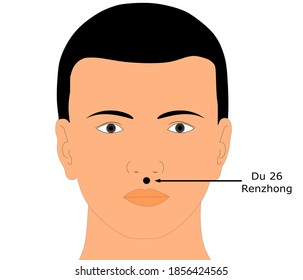 Acupuncture point Du Mai 26 or Du 26 that is known as Renzhong