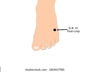 Acupuncture point gall bladder 41 (G.B. 41) that is also known as Foot-Linqi 
Gall bladder 41
G.B. 41