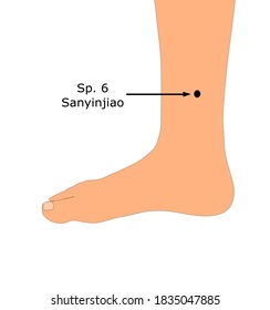 Acupuncture point Spleen 6 (Sp. 6) that is also known as Sanyinjiao