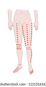 Acupuncture points of feet. Massage of the lower extremities. Vector. Isolated on white background
