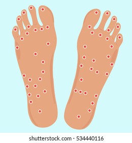 Acupuncture points on foots in Vector