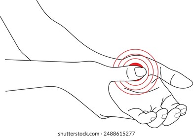 Acupuncture points on hand, Human anatomy