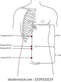 Acupuntura aponta St.21, St.25, St.26, St.29 que também são conhecidos como Liangmen, Tianshu, Wailing, Guilai.