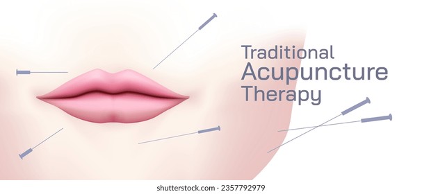 Acupuncture is the practice of penetrating the skin with thin, solid, metallic needles which are then activated through gentle and specific movements of the practitioner's hands vector illustration.