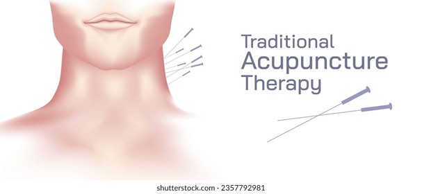 Acupuncture is the practice of penetrating the skin with thin, solid, metallic needles which are then activated through gentle and specific movements of the practitioner's hands vector illustration.