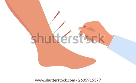 Acupuncture Therapy in Spa Salon. Hand Injects Needles in human foot. Chinese needle alternative medicine and treatment.