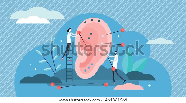 Acupuncture vector illustration. Flat tiny needle therapy persons concept. Alternative medicine form with body injection points as pain killer. Chinese traditional medicine for disease prevention.