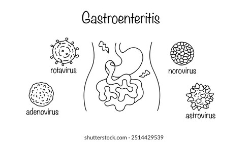 Acute or chronic inflammation of the mucous membrane of the stomach and small intestine, predominantly of an infectious nature. Viruses that cause gastroenteritis. Hand drawn line illustration.