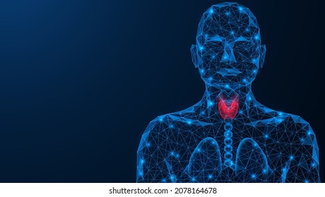 Inflamación aguda de la glándula tiroidea. Diseño de polos bajos de líneas y puntos interconectados. Fondo azul.