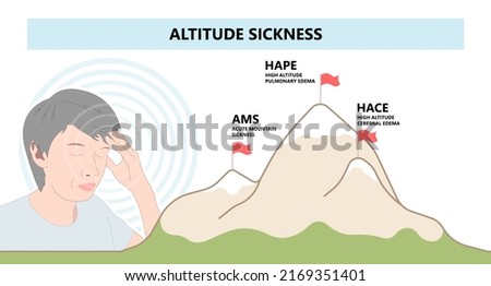 Acute mountain sickness first aid with shortness of breath prevention