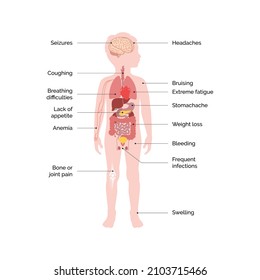 Acute Myeloid Leukemia, Symtom of AML, Boy Anatomy, Children Anotomy, Body Parts, Kids Anatomy, Symptoms, Internal Body Parts, Anatomy, Illustration, vector 