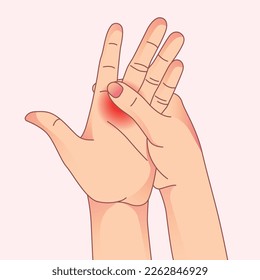 Dolor agudo en la mano. Artritis y problemas de tendón, fracturas, túnel carpiano en dolor de mano. 