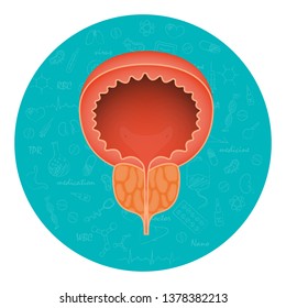 Acute prostatitis. Men's reproductive system disease. Medical vector illustration