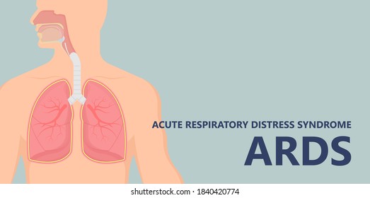 Acute respiratory distress syndrome (ARDS) a respiratory failure and inflammation in the lungs equipment hospital Emphysema fibrosis idiopathic Cystic Collapsed pneumothorax embolism