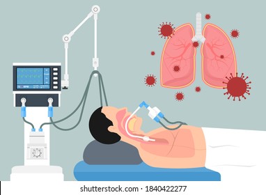 Acute Respiratory Distress Syndrome (ARDS) A Respiratory Failure And Inflammation In The Lungs Equipment Hospital Emphysema Fibrosis Idiopathic Cystic Collapsed Pneumothorax Embolism