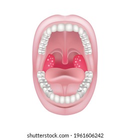 akute Tonsillitis und Pharyngitis. Blähungen und Rötung der Mendale. Brustschmerzen. Vektorgrafik.