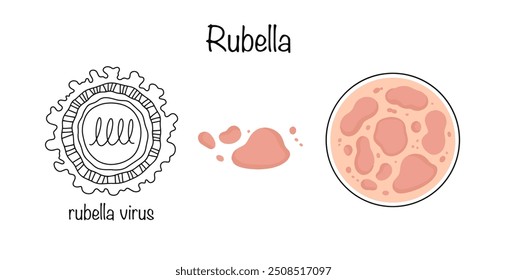 Doença viral aguda caracterizada pelo aparecimento de erupções cutâneas. O agente causador da doença e as manifestações da doença na pele. Ilustração vetorial para diferentes usos.