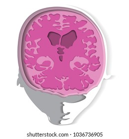 AD brain illustration 