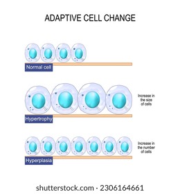 adaptive cell change. Normal cell, hypertrophy is an increase in the size of cells, and hyperplasia -increase in the number of cells. Vector Poster for education, science, and medical use