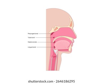 Cartaz médico adenoide, tonsila faríngea, uma massa de tecido linfoide localizado na parte superior da garganta atrás do nariz. Conceito de sistema imunitário. Ilustração de vetor plano médico de saúde infantil.