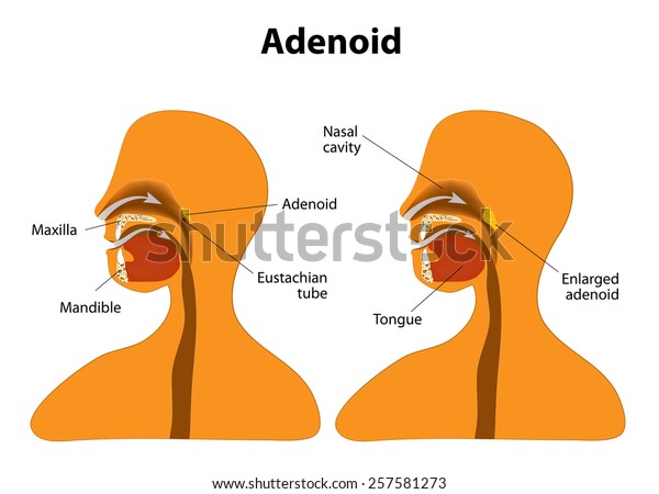 Adenoids Human Anatomy Picture Function Location More