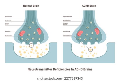 ADHD brain concept. Attention deficit hyperactivity disorder, neurotransmitters deficiency. Neurochemical disorder. Flat vector illustration