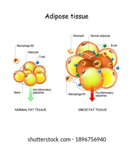 Adipocytes, obesity, and inflammation. normal fat tissue, metabolism, and obese adipose tissue. pathology of obesity. anti- and pro-inflammatory adipokines. Vector illustration