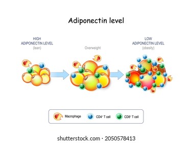 Adiponectin level. Lean people have High level, Obesity people with Overweight have Low Adiponectin level. Adipocytes in the fat tissue,  Macrophage and T-cell in adipose tissue with inflammation