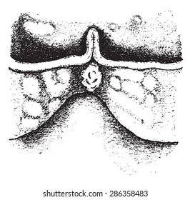 Adjacent aortic cusps, vintage engraved illustration.