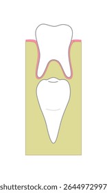 Dente adulto sob dente infantil na mandíbula, anatomia da seção transversal.