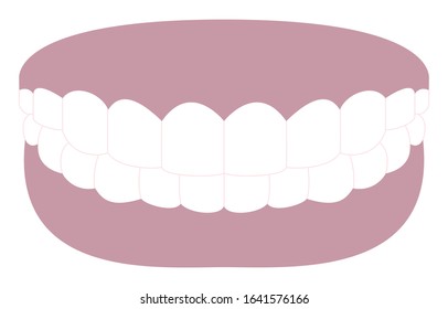 Aesthetic dentistry, illustration of white teeth and dark gums