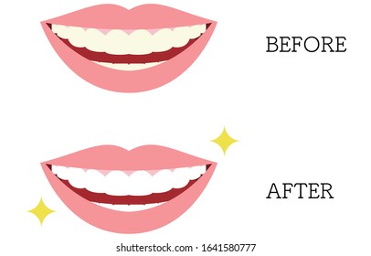 Aesthetic dentistry  illustration