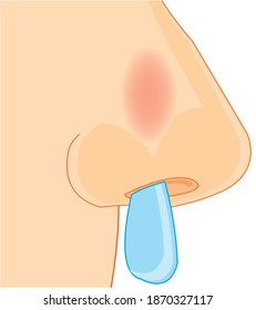 Affected by cold nose of the person on white background is insulated