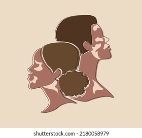 Mujer afroamericana y hombre con vitiligo. Cara de dibujo de línea continua. Concepto para apoyar a las personas que viven con vitiligo, cuerpos positivos. Día Mundial del Vitiligo. Impresión de postales, carteles, etc. 