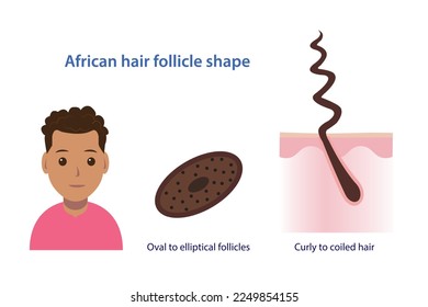 African hair follicle shape vector illustration isolated on white background. Cross section of oval to elliptical follicles. Curly to coiled, frizzy, kinky hair with scalp layer. Hair anatomy concept.