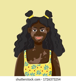 African smiling girl with vitiligo in a sundress, Banner template about skin diseases, differences between people. Poster about a person's acceptance of their appearance. Cartoon vector illustration.