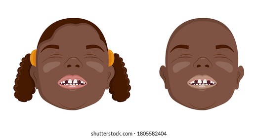 African toothless boys and girls smiling, fallen milk teeth, vector illustration.