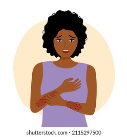 African Woman Scratching Arm. Black Female Suffering From Strong Allergy Skin Itchy Symptom In Flat Design. Red Rash Skin Irritation.