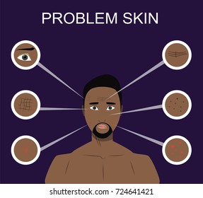 Afro man with problem skin such as acne, wrinkles, dark spots. Illustration for cosmetic websites, brochures. Facial care concept. Face care for men.