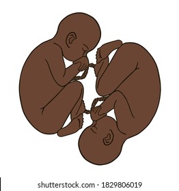 Afroamerican twins fetus concept hand drawn vector illustration prenatal growing baby, umbilicle cord isolated on a white background as an obstetric medicine symbol for pregnancy health and fetal