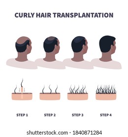 Afro-textured hair transplantation surgery result infographics. African male patient before and after hair loss treatment with FUT, FUE methods. Treating alopecia medical poster. Vector illustration.