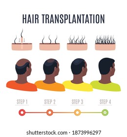 Afro-textured hair transplantation surgery steps infographics. African male patient getting hair loss treatment with FUT, FUE methods. Treating alopecia medical poster. Vector illustration.