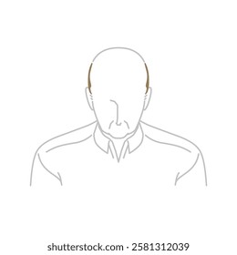 AGA: A middle-aged man with thinning hair seen from the front (top view)