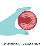 Agar plate method cell colony growth loop Bacteria Test blood stool urine mucus spinal fluid Sepsis Lab microbe fungi virus exam throat strep petri dish pour c diff germs Inoculate bacteriological