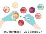 Agar plate method cell colony growth loop Bacteria Test blood stool urine mucus spinal fluid Sepsis Lab microbe fungi virus exam throat strep petri dish pour c diff germs Inoculate bacteriological