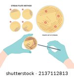 Agar plate method cell colony growth loop Bacteria Test blood stool urine mucus spinal fluid Sepsis Lab microbe fungi virus exam throat strep petri dish pour c diff germs Inoculate bacteriological