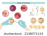 Agar plate method cell colony growth loop Bacteria Test blood stool urine mucus spinal fluid Sepsis Lab microbe fungi virus exam throat strep petri dish pour c diff germs Inoculate bacteriological