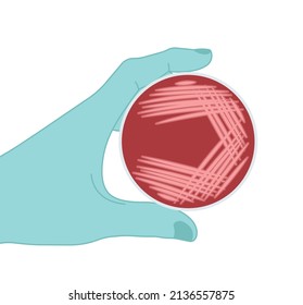 Agar Plate Method Cell Colony Growth Loop Bacteria Test Blood Stool Urine Mucus Spinal Fluid Sepsis Lab Microbe Fungi Virus Exam Throat Strep Petri Dish Pour C Diff Germs Inoculate Bacteriological